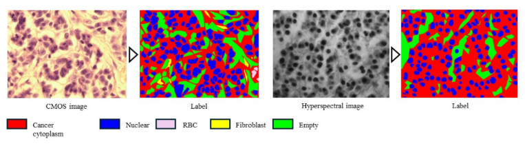 医療画像の解析